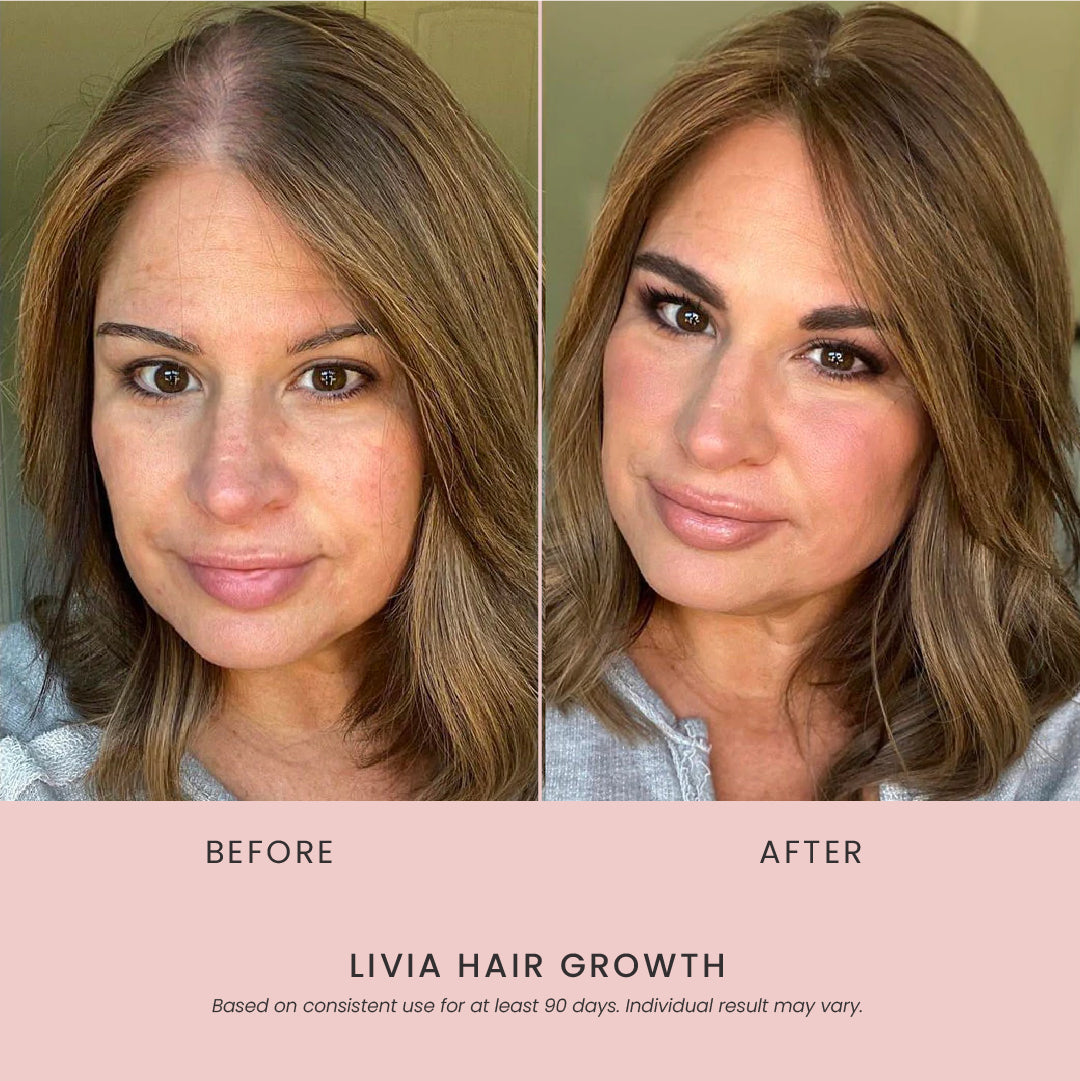 Livia Hairgrowth Shampoo & Conditioner Kit