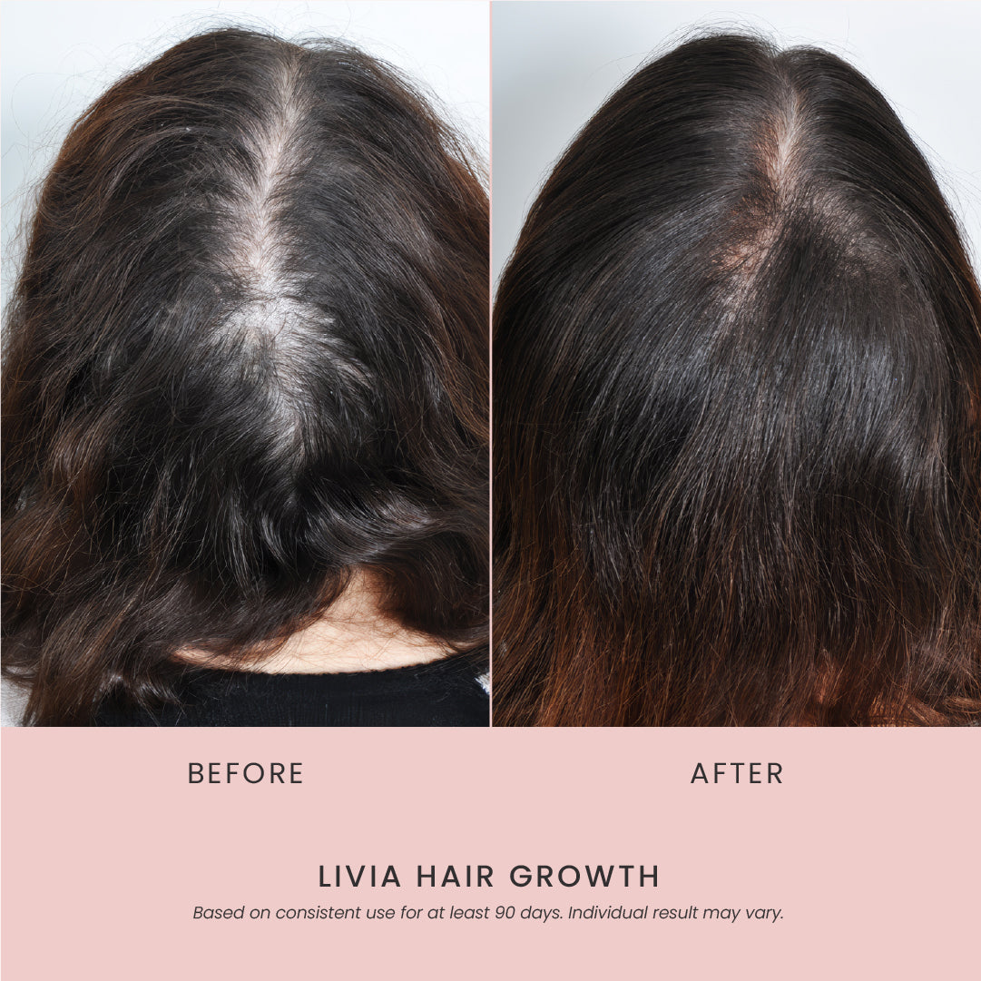 Livia Hairgrowth Serum Trio