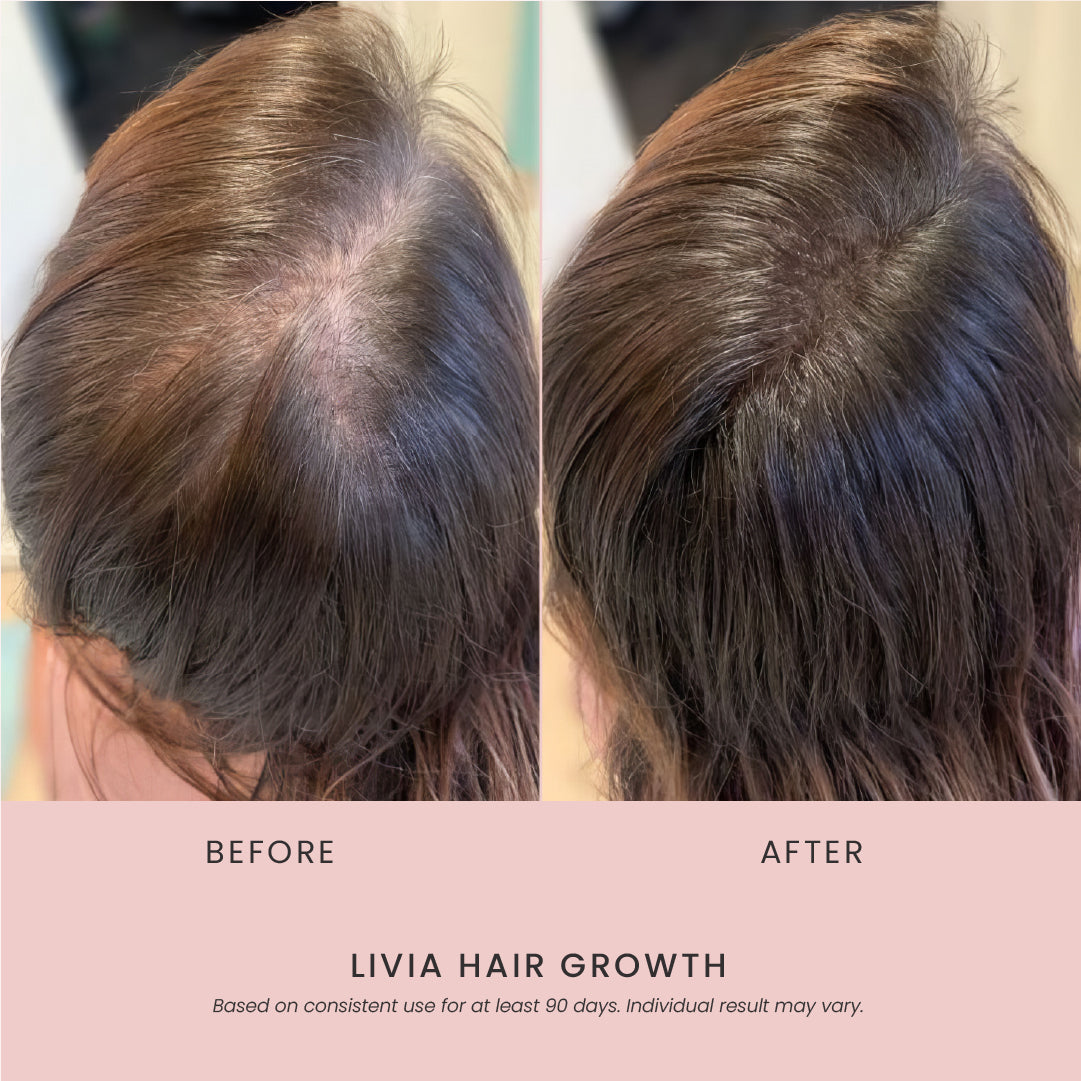 Livia Hairgrowth Serum Trio